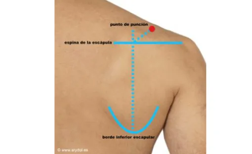 Imagen relativa a la noticia indicada