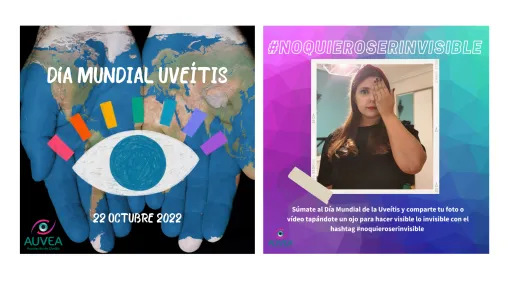 Mujer que se tapa con la mano un ojo