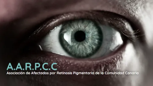 Imagen de un primer plano de ojo azul, con las siglas de la asociación, AARPCC, en la parte inferior izquierda, también en ezul y en blanco el nombre de la entidad: Asociación de Afectados por Retinosis Pigmentaria de la Comunidad Canaria