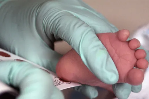 Día Mundial del Cribado Neonatal