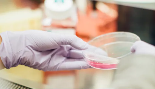 Unas manos sostienen una placa de Petri en un laboratorio