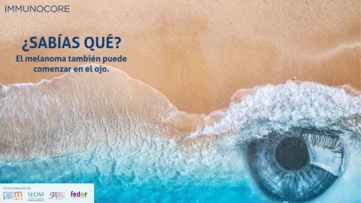 immunocore ¿Sabías qué? El melanoma también puede comenzar en el ojo