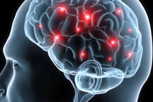 Cartel Jornadas sobre Epilepsia